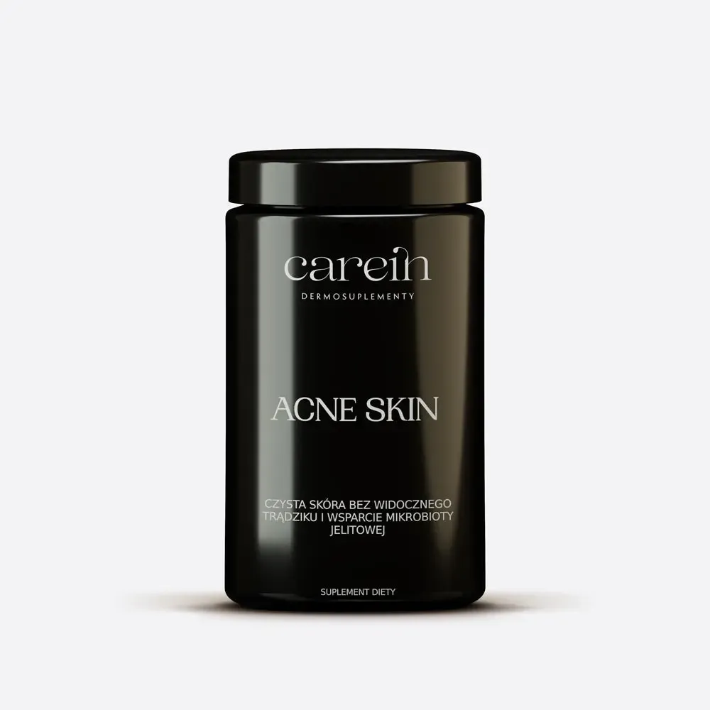 Acne Skin